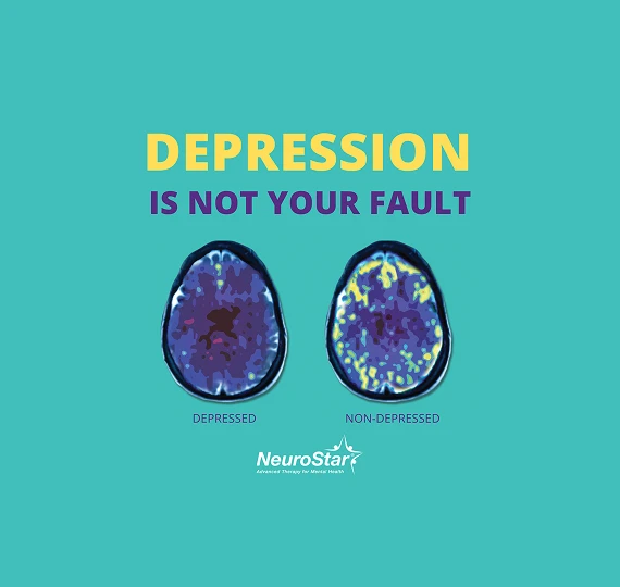 Front Street Clinic offers NeuroStar Advanced Therapy – TMS (transcranial magnetic stimulation) Therapy is an FDA-cleared non-invasive medical treatment for patients with major depression who have not benefited from antidepressant medications.