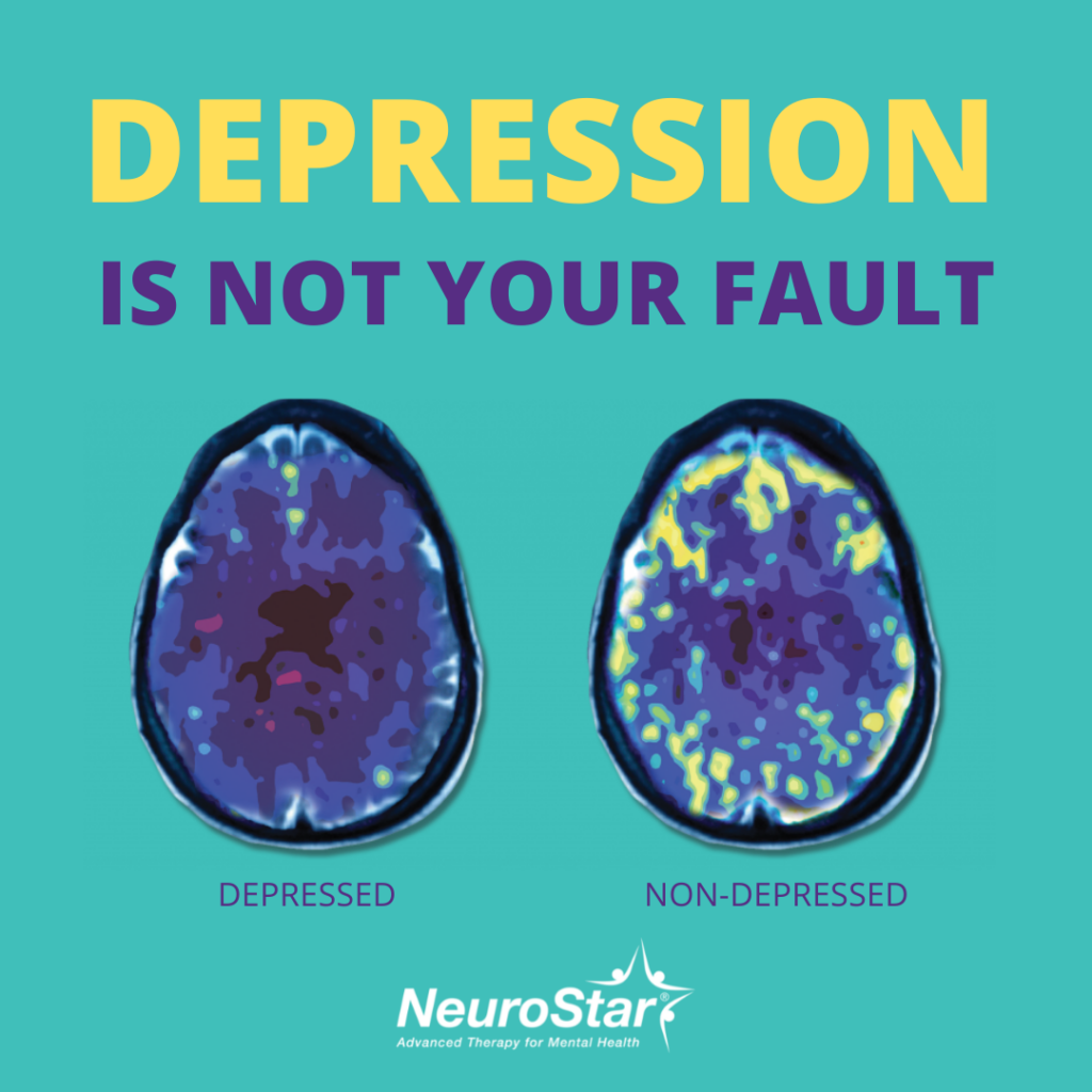 Front Street Clinic offers NeuroStar Advanced Therapy – TMS (transcranial magnetic stimulation) Therapy is an FDA-cleared non-invasive medical treatment for patients with major depression who have not benefited from antidepressant medications.